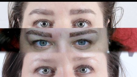 Micro Brow Implant Nedir? 